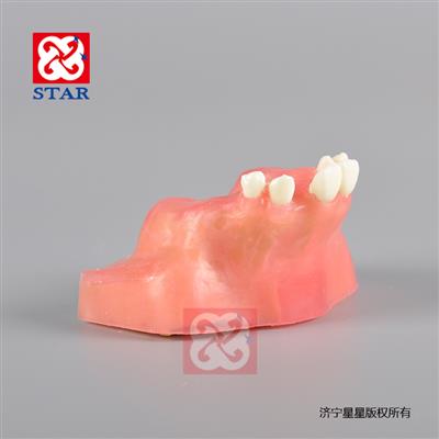 種植切開(kāi)縫合練習(xí)可用超聲骨刀練習(xí)仿骨質(zhì)